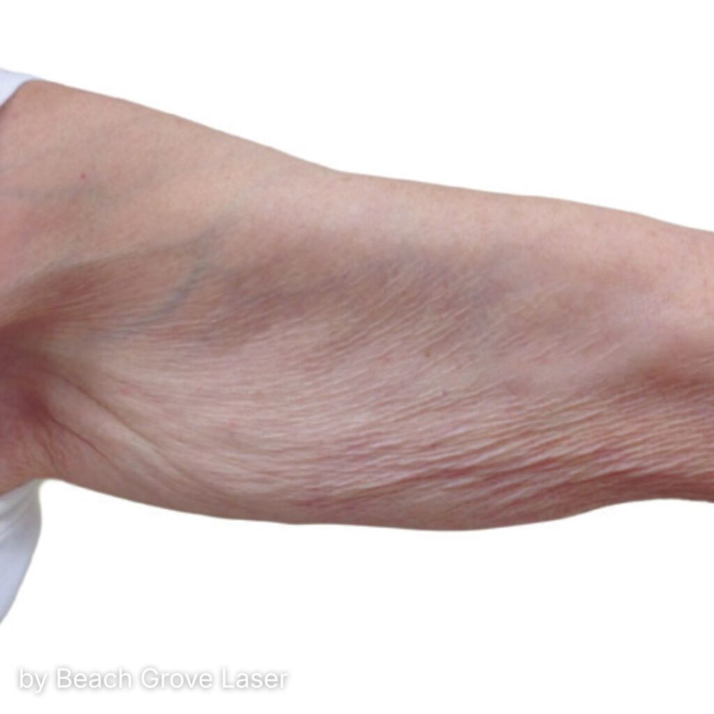 PRZED